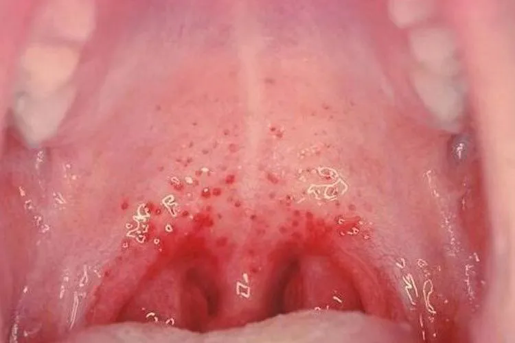 1721202634261092711.png 640.webp.png